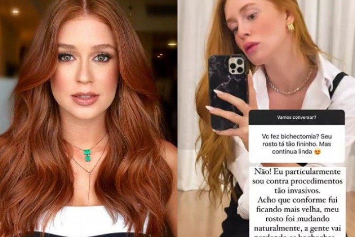 Marina Ruy Barbosa nega bichectomia